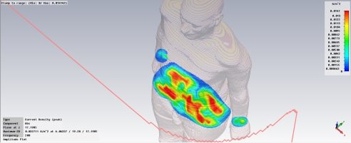 Simulazione 3D di correnti indotte nel corpo umano da campi magnetici a bassa frequenza