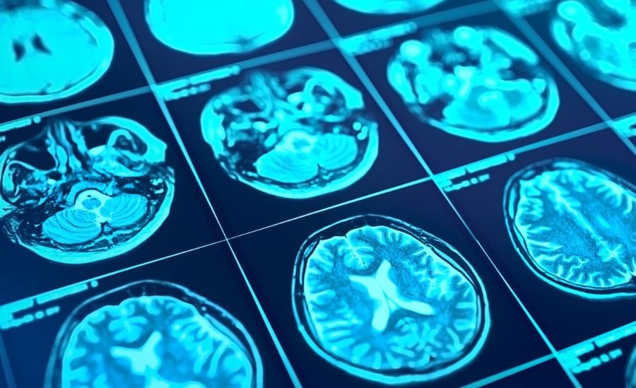 Head Scanning Series with Brain Structure